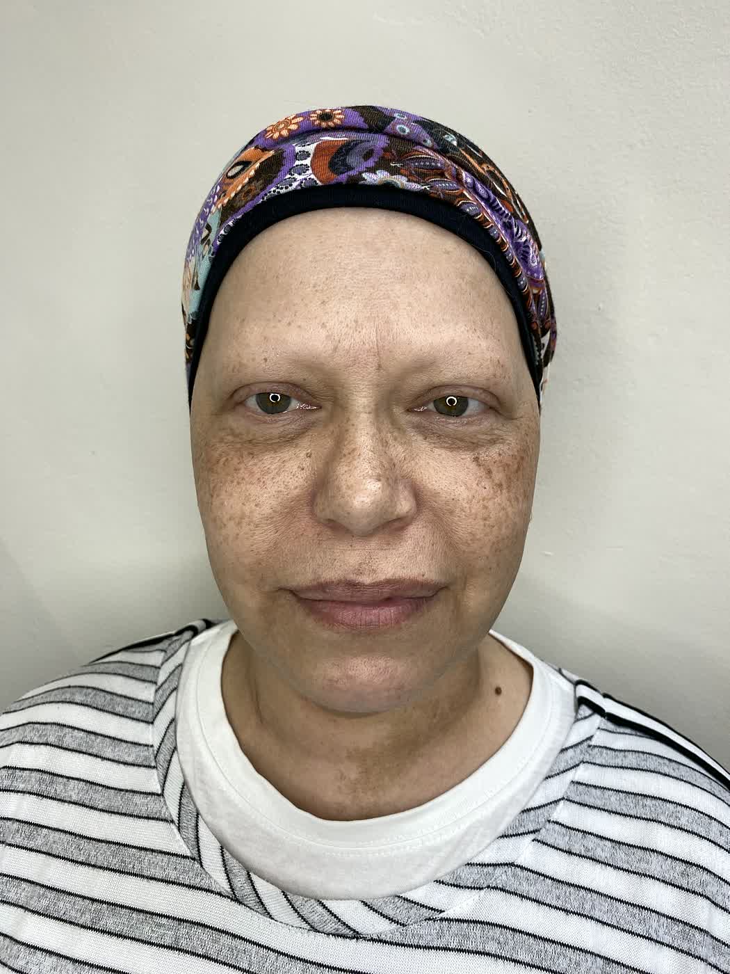 Antes del tratamiento de cejas en clienta adulta